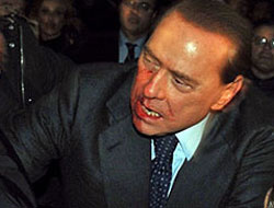 Berlusconiye yatakta da rahat yok